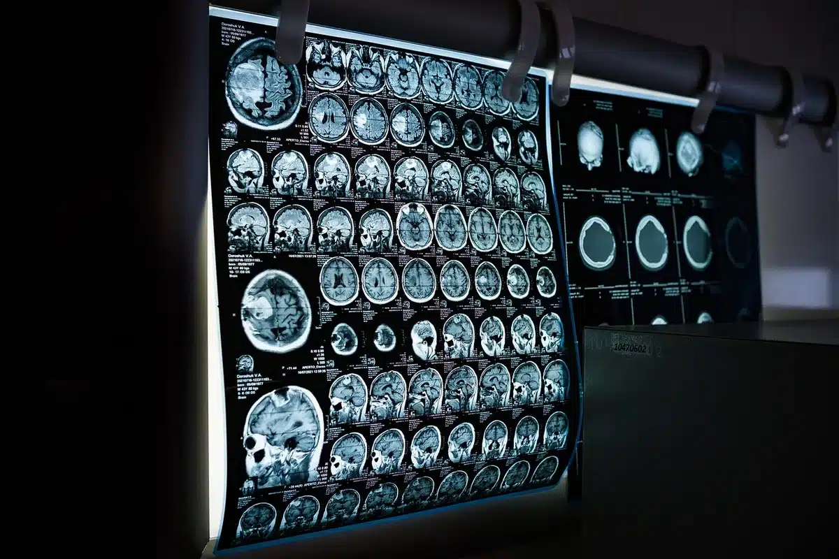 Scansione tomografica di un cranio antico presso un museo di storia naturale